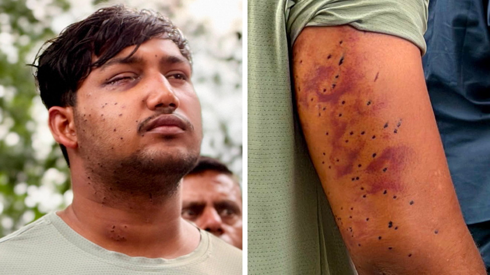 Pellet Guns Witnessed in Delhi Protest – Video Proof and Expert Analysis