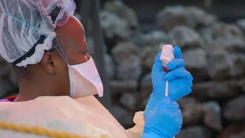 Ebola Outbreak in DR Congo: 80 Lives Lost