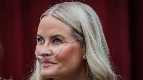 Norway's Crown Princess Receives Life‑Saving Lung Transplant